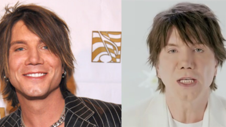 John Rzeznik Plastic Surgery